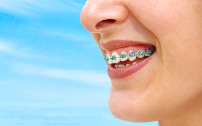 The Numerous Benefits Of Invisalign Aligners In Medina OH