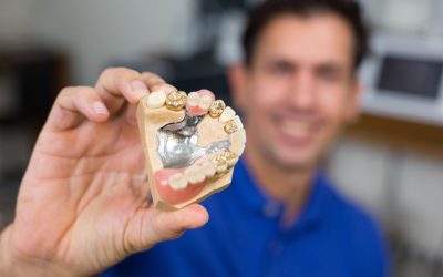 What You Should Know about Dental Gold Buyers in San Francisco?