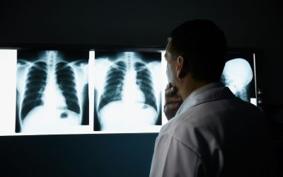 Breaking Down X-Ray in Mandarin: A Patient-Centric Approach to Diagnostics